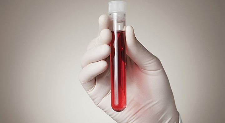 Multiple Sclerosis onderzoek in vitro-to-patient toolbox