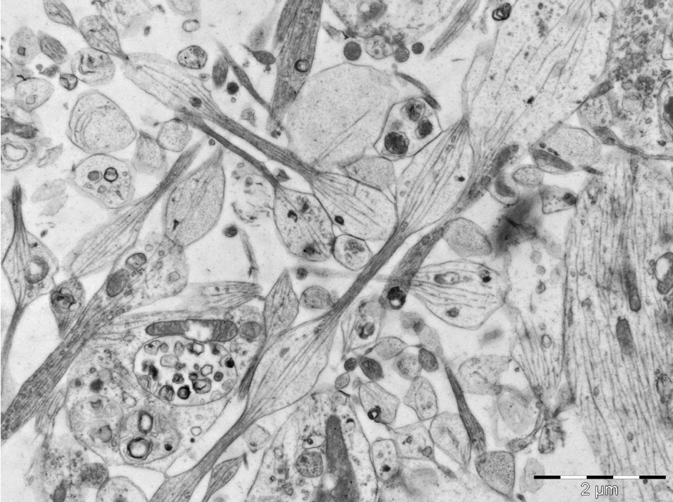 Advanced Microscopy